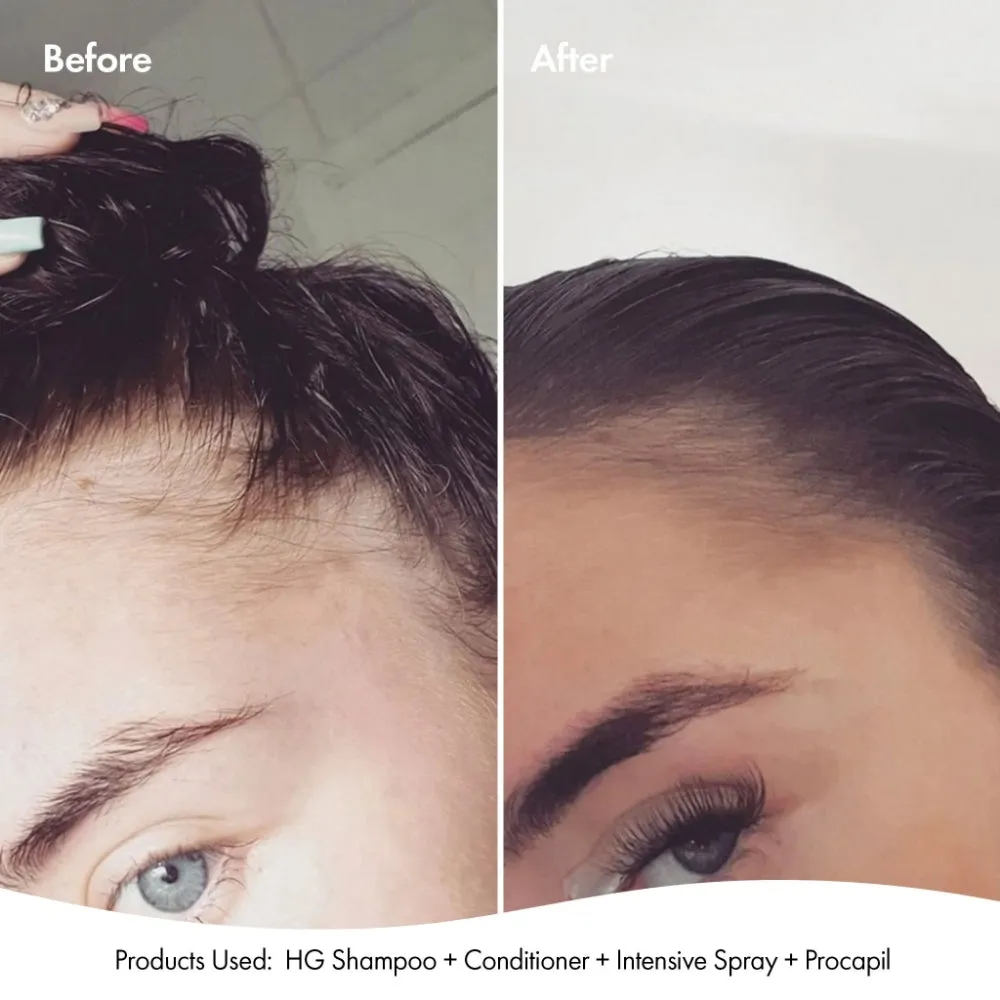BondiBoost Anti-Thinning Intensive Scalp Spray 125ml